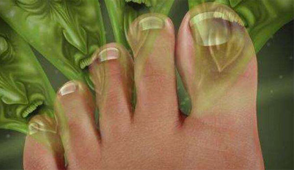 �ų���ʲôԭ�� �ճ�������η��νų�